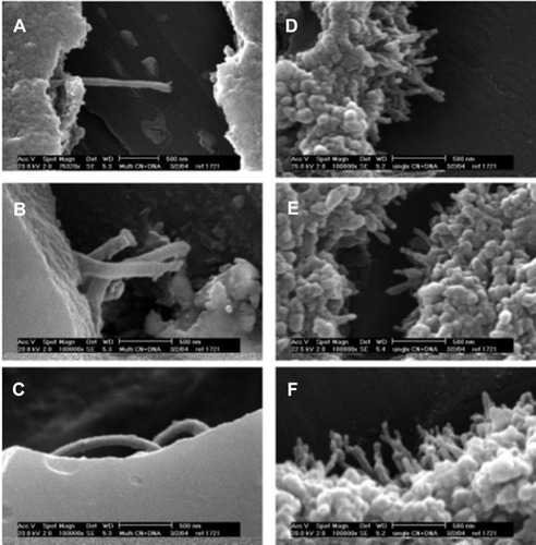 Figure 5 SEM images of carbon nanotube: DNA complexes formed at a 6:1 charge ratio: (A-C) MWNT-NH3 +:DNA; (D-F) SWNT-NH3 +:DNA. Reprinted with permission from Singh R, Pantarotto D, McCarthy D, et al. Binding and condensation of plasmid DNA onto functionalized carbon nanotubes: toward the construction of nanotube-based gene delivery vectors. J Am Chem Soc. 2005;127(12):4388-4396.Citation114,Citation139 Copyright (2020) American Chemical Society.