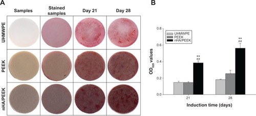 Figure 10 Alizarin-red staining and quantitative analysis of mineralization on the samples.Notes: (A) samples, stained samples without cells, and stained samples with cells at 21 and 28 days; (B) colorimetric quantification of the extracellular matrix mineralization at 21 and 28 days. **Significant difference compared with PEEK (P<0.01); ##significant difference compared with UHMWPE (P<0.01).Abbreviations: OD, optical density; nHA/PEEK, nano-hydroxyapatite/polyetheretherketone; PEEK, polyetheretherketone; UHMWPE, ultra-high-molecular-weight polyethylene.