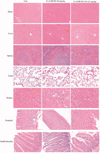 Figure 9. Histopathological examination (H&E staining, ×200) of various organs of the KYSE520 xenograft-bearing athymic mice treated with Fv-LDP-D3 (40 mg/kg), Fv-LDP-D3-AE (0.50 mg/kg), respectively.