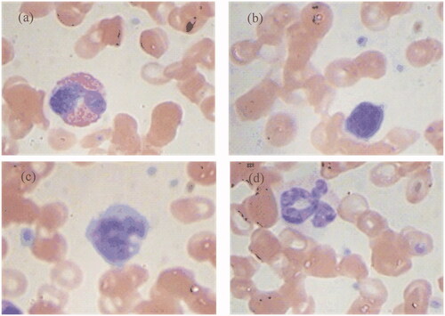 Figure 2. White blood cells of BCCD data set. (a) EOS, (b) LYM, (c) MON, (d) NEU.