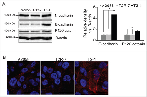 Figure 3. TIMP-2 and E-cadherin. (A) E-cadherin and N-cadherin protein expression in human melanoma cell lines. Densitometry of E-cadherin v.s. β-actin was measured. Data are expressed as mean ± SD. #P< 0.05. n= 3 separate experiments. (B) Distribution of E-cadherin by immunostaining. Blue: DAPI; Red: E-cadherin.