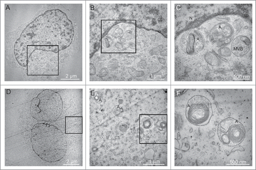 Figure 5. Effect of nutlin-3 treatment on autophagy induction observed by electron microscopy. (A, B and C) BL2/B95 cells, (D, E and F) RPMI8866 cells. B and C, and E and F, are successive magnifications of A and D, respectively. Nucleus (N), multivesicular body (MVB) and autophagosomes (A) as indicated.