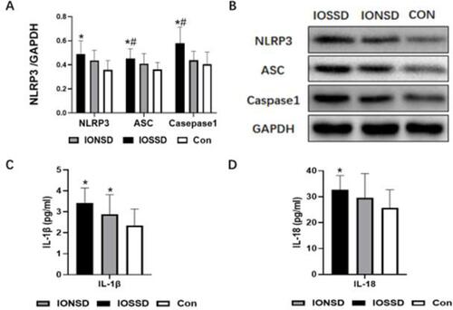 Figure 2 Activation of peripheral NLRP3 inflammasome in insomnia patients with objective short sleep duration. (A and B) Relative expression levels (A) and Western blot bands (B) of peripheral NLRP3, ASC, and caspase l, normalized to the values of GAPDH in IOSSD, IONSD, and healthy controls. (C and D) Serum levels of IL-lβ (C) and IL-18 (D) determined by ELISA. Results are presented as mean ± standard deviation. One-way ANOVA *P < 0.05 versus healthy controls; #P < 0.05 versus IONSD.