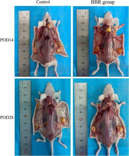 Figure 6 Anatomy of fat grafting site after operation.