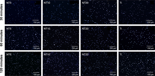 Figure S3 The initial PDLSC adhesion on the Ti samples displayed by DAPI-staining followed by observation under the fluorescence microscopy, after 30, 60, and 120 minutes of incubation.Note: Scale bars are 150 μm.Abbreviations: DAPI, 4′,6′-diamidino-2-phenylindole; PDLSC, periodontal ligament stem cell; Ti, titanium.