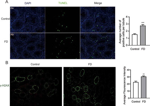 Figure 2. Folic acid deficiency increased apoptosis and genome breakage in testicular tissues. Immunofluorescent images of (A) TUNEL-positive cells (green) and (B) γ-H2AX foci (green) in testicular tissues. The nuclei were stained blue with DAPI. All experiments were performed n = 6 in replicates. Data were presented as mean ± SEM. **P < 0.01, ***P < 0.001