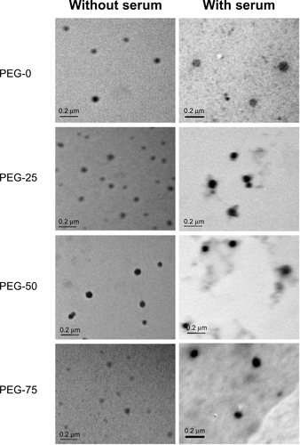 Figure S3 TEM images of micelles in the absence (left) and presence (right) of serum (stained with uranyl acetate) at 37°C (scale bar: 0.2 μm).Abbreviation: TEM, transmission electron microscopy.