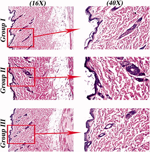 Figure 6. Light microscope photomicrographs showing histopathological sections (hematoxylin and eosin stained) of rat skin normal control (group I), rat skin treated with SP suspension (group II) and rat skin treated with OHAEC (group III) with magnification power of 16X to illustrate all skin layers (Left side) and magnification power of 40X to identify the epidermis and dermis (Right side). Abbreviation: SP: spironolactone, OHAEC: optimal hyaluronic acid enriched cerosomes.