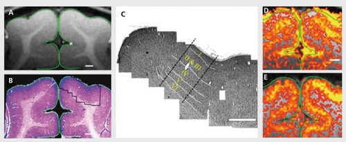 Figure 1. Coregistration of magnetic resonance (MR) image with the corresponding cortical tissue: Following the MR imaging session, the animals were sacrificed and the cortical tissue was stained for cytoarchitectonic structures, (a) A high-resolution MRI. (b) Low-magnification photograph of the corresponding Nissl stain (histology) of the same region, (c) A mosaic reconstruction of high magnified Nissl-stained images (right hemisphere) of cortical tissue corresponding to the imaged plane (outlined in panel b). White lines: the anatomically defined borders between cortical layers, (d) and (e) High-resolution blood oxygen level-dependent and cerebral blood volume functional MRI (0.15x0.15 mm2) maps for a 40-s drifting bars stimuli. Signal changes were confined to the primary visual areas and closely followed the gray matter contour. In both maps, a spatially defined band of elevated signal changes was centered over layer IV as defined anatomically in panel c. Adapted from ref 44: Harel N, Lin J, Moeller S, Ugurbil K, Yacoub E. Combined imaging-histological study of cortical laminar specificity of fMRI signals. Neuroimage. 2006;29:879-887. Copyright © Elsevier 2006