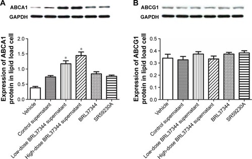 Figure 6 Medium supernatant of HepG2 cells, which were treated with BRL37344, increases ABCA1 but not ABCG1 expression in macrophages.