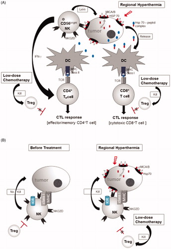 Figure 5. (A) Working hypothesis of (heat) stress-induced immune activation. CD56bright NK cells expressing the NKG2D activating receptor Display full size interact with MICA/B Display full size and HSP70 Display full size that are co-induced on tumor cells by regional hyperthermia. Activated CD56bright NK cells have the capacity to lyse tumor cells directly [Citation18,Citation20,Citation37–39]. CD56bright NK cells secret IFN-γ and thereby promote the activation of CD4+ helper T cells. CD4+ helper T cells recognize tumor peptides Display full size presented by MHC class II molecules on DCs and thereby can stimulate the CTL response of CD4+ effector/memory T cells (modified from Ref. [Citation7]). Alternatively, HSP70-chaperoned tumor peptides (HSP70-peptide complexesDisplay full size) released from the dying tumor (immunogenic cell death through hyperthermia) are taken up by DCs. Cross-presentation of peptides by MHC class I molecules on DCs then stimulate the response of CD8+ cytotoxic T cells [Citation37,Citation38]. Low-dose chemotherapy is able to kill Treg cells, thereby, blocking the immunosuppressive effects of Treg cells on the CTL response [Citation16]. (B) Despite the setting of HLA haplotype-mismatched HSCT, where NK cells are not inhibited by KIR/HLA class I interactions, tumor cell killing does not occur if the tumor cells lack activating ligands (MICA, HSP70) for the NK cell-expressed activating receptor NKG2D and if Tregs are present (modified from Refs. [Citation7,Citation22]). The capacity of allogeneic cytotoxicity of NK cells can be restored by hyperthermia which is known to induce MICA/B and HSP70 expression on the tumor cells. This provides the signals for the NKG2D activating receptor expressed on NK cells [Citation18]. Low-dose chemotherapy is able to kill Treg cells, thereby blocking the immunosuppressive effects of Treg cells on the allogeneic NK activity [Citation16]. Abbreviations: CTL: cytotoxic T cell; DC: dendritic cell; HLA: human leukocyte antigen; HSP: heat shock protein; HSCT: hematopoietic stem cell transplantation; IFN-γ: interferon gamma; KIR: killer immunoglobulin-like receptor; MIC or MIC: MHC class I chain-related protein family; MHC: major histocompatibility complex; NK: natural killer; NKG2D: natural killer group 2D; Treg: regulatory T cells.