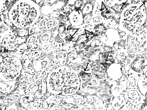 Figure 8. Iron-stained kidney section of a glycerol+saline-treated rat (ARF group). There are distinct granular deposits (arrows), showing iron accumulation (iron stain, × 100).