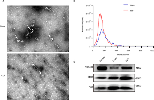Figure 2 Isolation and identification of Lung Tissue exosomes. (A) Transmission electron micrographs of lung tissue exo-somes isolated from sham and ALI mice. Scale bar, 200 nm, The white arrows in (A) represent exosome particles. (B) NTA shows the concentration and size distribution of lung tissue exosomes isolated from the sham group and CLP mice (n=6 in each group). (C) Western blot analysis of the lung tissue exosomal markers TSG101, CD63 and CD9.