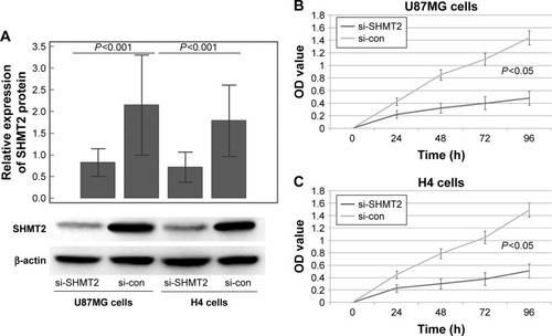 Figure 3 SHMT2 regulates cell proliferation of glioma cells in vitro.