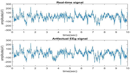 Figure 2. Real-time EEG signal and artifactual EEG signal