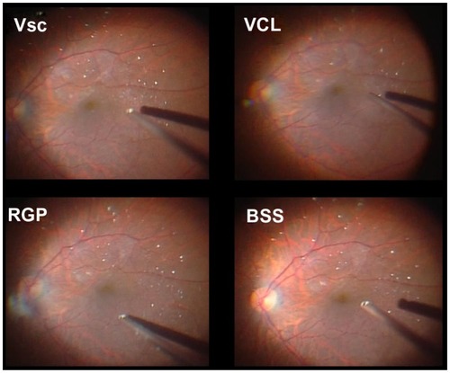Figure 3 Representative fundus images through each material at the time of membrane peeling with 60-degree objective lens.