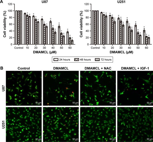 Figure 1 DMAMCL inhibits the viability of glioma cells and induces cell death.Notes: (A) Dose- and time-dependent effects of DMAMCL on cell viability. U87-MG and U251 glioma cells were administered different concentrations of DMAMCL (10, 20, 30, 40, 50, and 60 μM) for 24, 48, and 72 hours, and cell viability was assessed via CCK-8 assays. *Indicates statistically significant difference (P<0.05) vs untreated control cells. (B, C) Effects of DMAMCL, ROS scavenger NAC, and Akt activator IGF-1 on U87-MG and U251 cells. The percentage of dead cells (red) increased compared with the control. *Indicates statistically significant difference (P<0.05) vs untreated control cells. #Indicates significantly different (P<0.05) compared with DMAMCL treatment. Scale bars =50 μm. (D) The CCK-8 proliferation assay using U87-MG and U251 cells was performed with different treatments (40 μM DMAMCL for 48 hours; 3-MA [100 nM] for 48 hours; 40 μM DMAMCL and 3-MA [100 nM] for 48 hours; pretreatment with NAC [5 mM] for 2 hours and then culture media for 48 hours; pretreatment with NAC [5 mM] for 2 hours, followed by 40 μM DMAMCL for 48 hours; IGF-1 [100 ng/mL] for 48 hours; 40 μM DMAMCL and IGF-1 [100 ng/mL] for 48 hours). *Indicates statistically significant (P<0.05) vs untreated control cells. #Indicates significantly different (P<0.05) compared with DMAMCL treatment. Data are expressed as the mean ± SD of three independent experiments.Abbreviations: 3-MA, 3-methyladenine; CCK-8, Cell Counting Kit-8; DMAMCL, dimethylaminomicheliolide; IGF-1, insulin-like growth factor-1; NAC, N-acetyl-L-cysteine; ROS, reactive oxygen species.