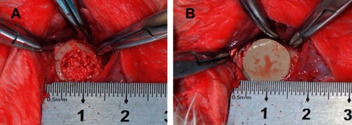 Figure 3 Illustration of the surgical procedure. (A) Bone defects with a diameter of 8-mm were created on rabbit mandibles, and then filled with DBB granules. (B) Bone defects were covered with polarized BTO/P(VDF-TrFE) nanocomposite membranes or commercially-available PTFE membranes.Abbreviations: DBB, deproteinized bovine bone; BTO, BaTiO3; P(VDF-TrFE), poly(vinylidene fluoridetrifluoroethylene); PTFE, polytetrafluoroethylene.