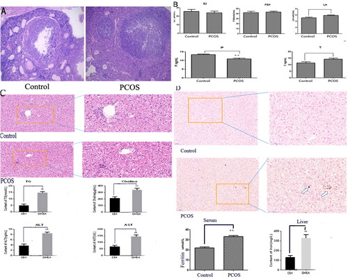 Figure 1. Increased Fe deposition in PCOS mice model with unexplained liver damage. (A) The ovarian tissue change demonstrated by HE staining; (B) the hormone change of PCOS mice; (C) HE staining of liver tissue and serum TG, Choline, ALT, AST changes; (D) Prussian blue staining of liver Fe deposition and Serum/liver Fe content analysis. The white arrowhead indicates the accumulated Fe in the liver. The DHEA group in this figure equals PCOS group. *p < .05; **p < .01.