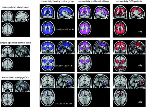 Figure 1. Seed regions are depicted on the left side. The fronto-parietal network consisted of four seed regions, the cingulo-opercular network of three regions, and the the fronto-parietal network of on seed region (subgenual ACC). On the right side the connectivity from each network seed with the rest of the brain is displayed for each group separately.