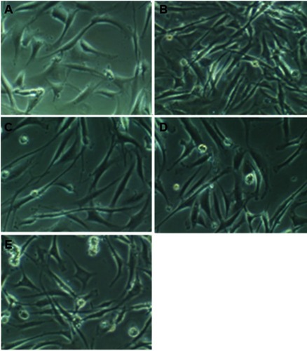 Figure 12 Morphological changes of hMSCs induced by different concentrations of SiO2 [0 (A), 10 (B), 50 (C), 100 (D) and 200 µg/mL (E)].