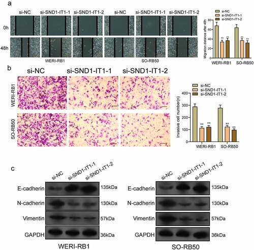 Figure 4. Knockdown of SND1-IT1 suppressed the metastasis of RB cells. (a) Wound healing assay was used to assess the migration of WERI-RB1 and SO-RB50 cells transfected with si-SND1-IT1-1, si-SND1-IT1-2 or si-NC, respectively. (b) The effect of SND1-IT1 on WERI-RB1 and SO-RB50 invasion was determined by transwell assays. (c) Knockdown of SND1-IT1 inhibited the EMT progress. **p < 0.01, *p < 0.05