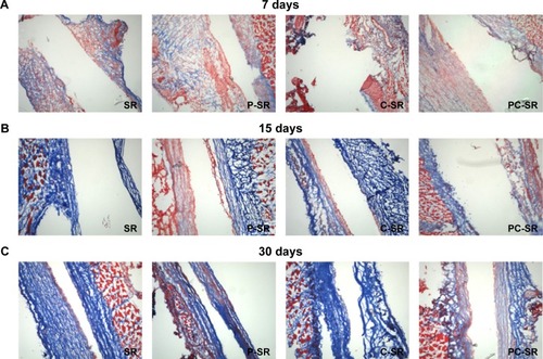 Figure 5 Masson staining evaluating the capsule thickness following implantation of silicone rubber materials. (×200)Notes: (A) 7 days. (B) 15 days. (C) 30 days.Abbreviations: SR, silicone rubber; P-SR, patterned silicone rubber; C-SR, C-ion-implanted silicone rubber; PC-SR, patterned C-ion-implanted silicone rubber.