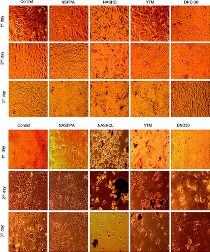 Figure 4. Overall morphology of MG-63 (A) and rMSCs (B) cells, incubated for three days with different DND particles, bar = 100 μm.