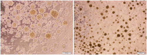 Figure 1. Colonies of proliferating CD4+ T-cells during in vitro human TH17 cell differentiation. For stimulation and expansion of the T-cells, polyclonal stimulators (including anti-CD3 and anti-CD28 antibodies) were used (see “Methods” section). Representative micro-images are shown with different magnifications.