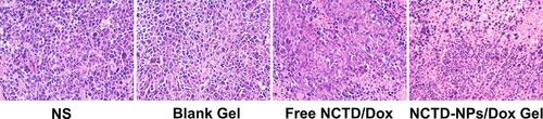 Figure 6 H&E-stained histological sections of tumors of the different groups (× 200).