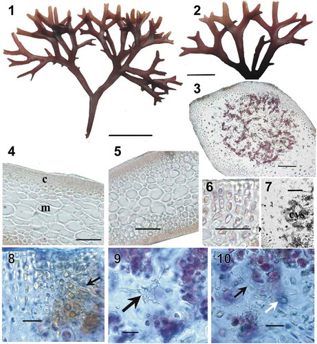 Figs 1–10. Besa divaricata, collected from Sukhoputnaya Bay, Sea of Japan, Russia. Fig. 1. Habit. Scale bar = 1 cm. Fig. 2. Details of apices. Scale bar = 5 mm. Fig. 3. Cross-section showing the mature cystocarp loosely immersed within the medulla. Scale bar = 200 µm. Fig. 4. Longitudinal section of a branch in the middle part of a thallus, showing cortex (c) and pseudoparenchymatous medulla (m). Scale bar = 100 µm. Fig. 5. Cross-section of a branch in the middle part of a thallus. Scale bar = 100 µm. Fig. 6. Cross-section showing details of 4–5 layered cortex. Scale bar = 40 μm. Fig. 7. Close-up view showing the absence of secondary medullary cells around the cystocarp (cys). Note the vegetative medullary cells with unmodified cell walls. Scale bar = 100 µm. Fig. 8. Close-up view showing a carpostome, a cavity composed of periclinal filaments (arrow) emerging from cortical cells. Scale bar = 20 µm. Fig. 9. Medullary cell (arrow) laterally connected to clusters of carposporangia. Scale bar = 20 µm. Fig. 10. Detail showing the fusion of fusiform conjunctor cells (black arrow) penetrating the cystocarp boundary to nearby vegetative cells (white arrow). Scale bar = 20 µm