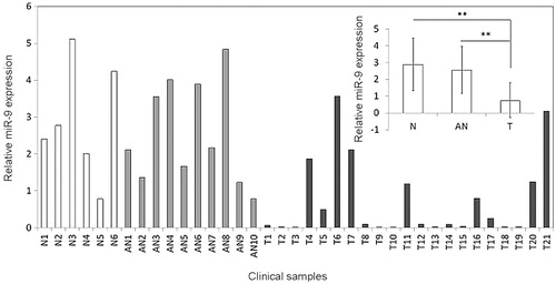 Figure 1. MiR-9 is down-regulated in OSCCs. Expression level of miR-9 in each individual case of OSCCs, adjacent normal tissues and normal mucosa tissues was evaluated using RT-qPCR. Small nuclear RNA (snRNA) U6 was used as an internal control. Data are presented as mean ± SD (insert). Details are described in the Materials and methods. T: OSCC tissues; AN: adjacent normal tissues; N: normal mucosa tissues; **p < .01.