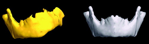 Figure 1. Diseased mandible (left) and mirrored healthy template (right). [Color version available online.]