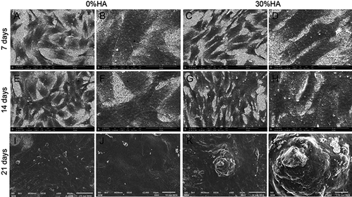 Figure 19. SEM images of attachment and proliferation of rBMSCs cultured on SF/HA scaffolds for 7, 14 and 21 days (a,c, e, g, i and k) scale bars = 100 µm; (b, d, f, h, j and l) scale bars = 50 µm [Citation185]