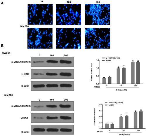 Figure 4 BGM induces DNA damage in the melanoma cells. (A and B) The WM239 and MM200 cells were treated with BGM at the indicated dose. (A) The DNA condensation was analyzed by the 4, 6-Diamidino-2-phenylindole (DAPI) staining in the cells. (B) The γH2AX phosphorylation (Ser139), expression of γH2AX and β-actin were measured by Western blot analysis in the cells. The results of Western blot analysis were quantified by ImageJ software. Data are presented as mean ± SEM. Statistic significant differences were indicated: **P < 0.01.