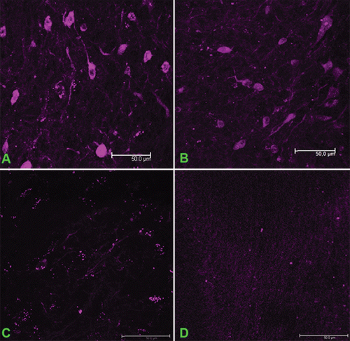 Figure 3.  Visualization of Cx43-positive cells in the glioma upon injection of different concentrations of monoclonal antibodies against the extracellular fragment of Cx43 labeled with Alexa Fluor 660. The doses of the injected MAbE2Cx43: (a) 500 μg/kg, (b) 100 μg/kg, (c) 50 μg/kg. (d) Non-specific mouse IgG conjugated with Alexa Fluor 660 (500 μg/kg). Scale bar, 50 μm.