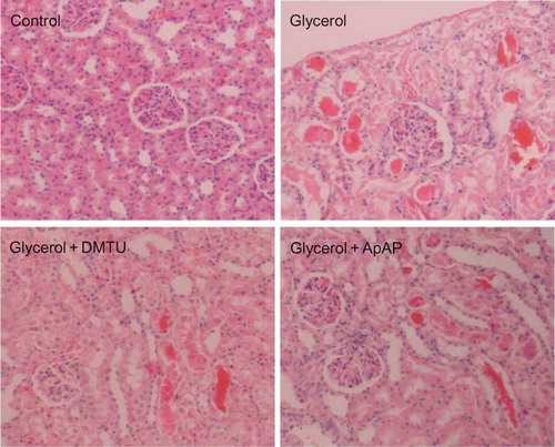 Figure 6. Histological appearances of kidneys from control group, glycerol-injected rats, and dimethylthiourea or acetaminophen-treated rats. DMTU, dimethylthiourea; ApAP, acetaminophen. Hematoxylin and eosin, ×100 magnification.