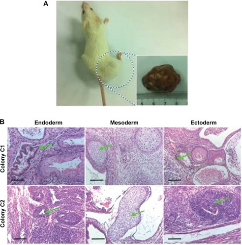 Figure 6 In vivo teratoma formation by injection of induced iPSCs.Notes: (A) Teratoma formation on NOD-SCID mice. (B) HE staining analysis of three germ layers (green arrow) in teratoma sections. Colony C1: endoderm (gut epithelium); mesoderm (cartilage); ectoderm (melanocyte). Colony C2: endoderm (secretory epithelium); mesoderm (cartilage); ectoderm (neuroepithelial rosettes). Scale bar =100 μm.Abbreviations: HE, hematoxylineosin; iPSC, induced pluripotent stem cell; NOD-SCID, nonobese diabetic-severe combined immunodeficient.