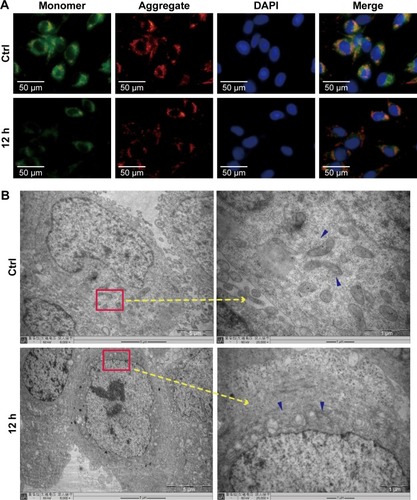 Figure 3 Effect of ZnO NPs on the MMP in CAL 27 cells.Notes: Cells were treated with or without 25 μg/mL ZnO NPs for 12 h. (A) The cells were then incubated with JC-1 for specified times, and the fluorescence intensity was evaluated using fluorescence microscopy. (B) Alterations in the shape of the mitochondria were detected by TEM. Blue arrows show the mitochondria, and the images revealed a greater number of swollen mitochondria around the nucleus in the experimental groups than in the control.Abbreviations: Ctrl, control; JC-1, tetraethylbenzimidazolylcarbocyanine iodide; MMP, mitochondrial membrane potential; TEM, transmission electron microscopy; ZnO NPs, zinc oxide nanoparticles.