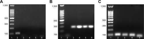 Figure 11 Electrophoresis results of Staphylococcus aureus and Streptococcus mutans pathogenic genes.Notes: (A) caL. 1-Maker; 2-16SrRNA; 3-G20; 4-G50; 5-G80; 6-G100. (B) nuC. 1-Maker; 2-16SrRNA; 3-G20; 4-G50; 5-G80; 6-G100. (C) S. mutans relative genes. 1-Maker; 2-16SrRNA; 3-gtfB; 4-gtfC; 5-gtfD.