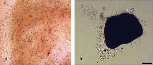 Figure 3. Submerged fermentation of M. rileyi MS. (a) The picture of fermentation yields of M. rileyi MS. (b) The germination of dried MS after incubation on agar for 36 h at 25°C (scare bar is 100 μm).