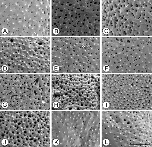 Figure 9. SEM, details of exine ornamentation inTrithuria spp. A–C. Trithuria submersa (Macfarlane 3902); D. T. bibracteata; E, F. T. occidentalis (Macfarlane 4141 & Tuckett); G. T. australis (Macfarlane 3357 & Hearn); H. T. polybracteata; I, J. T. konkanensis (I) Yadav s.n., 2007; (J) Yadav s.n., 2006; K, L. T. filamentosa (Wells et al. VM9). Scale bar common to all images – 2 µm.