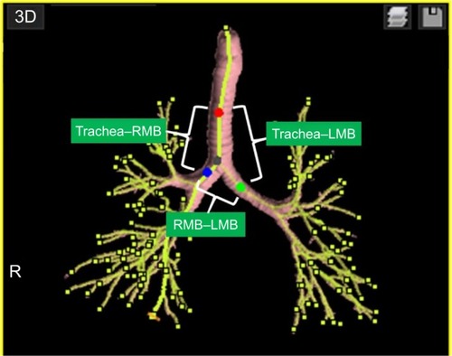 Figure 2 An example of tracheobronchial angle measurements by the research software.