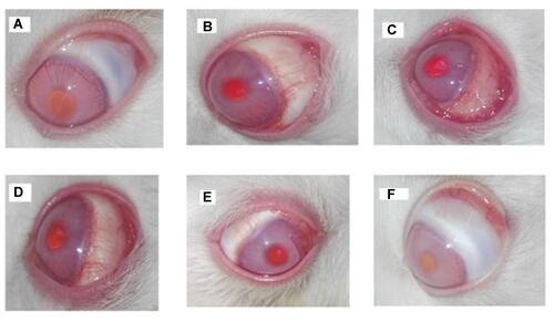Figure 8 Gross appearance of normal rabbit-eye normal conjunctiva and cornea with no mucus discharge (A), moderate hyperemia induced after 15 minutes of histamine instillation (B), severe hyperemia induced after 30 minutes of histamine instillation (C), treated with plain hydrogel (D), after 24 hours of treatment with free drug–loaded hydrogel (E), and after 24 hours of treatment with MZL-SLNs hydrogel (F).