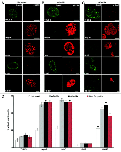 Figure 6. Nesprin-1 is required for an efficient NHEJ. (A, B, C) Loss of Nesprin-1 leads to increased γH2AX staining. Nesprin-1 (pAb SpecII, green) and γH2AX (red) staining of THLE-2, Hep3B, Huh7, C-HF, and Nesprin-1 KD-HF cells before (A), after HU (B), and after UV treatment (C). Arrow head indicates KD-HF cells after UV treatment. Scale bars, 10 µm. (D) Quantification of the percentage of cells presenting > 5 γH2AX-labeled foci before (white bar), after (gray bar) HU, after (black bar) UV, after (red bar) Etoposide treatment. Graphs show results from at least three independent experiments. Error bars represent standard deviations (*P < 0.001, **P < 0.0001). (E, F) Immunofluorescence analysis of Ku70 in THLE-2, Hep3B, Huh7, C-HF, and KD-HF cells before (E) and after HU and UV (F) treatment. pAb SpecII (green), Ku70 (red), and DAPI (blue). Bottom panels, arrow heads point to Nesprin-1 KD-HF cells. Scale bars, 10 µm.