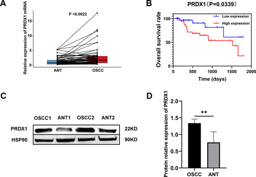 Figure 4 The expression level of PRDX1 in ANTs and OSCC tissues and the relationship between PRDX1 level and overall survival in patients with OSCC (testing cohort). (A) mRNA expression of PRDX1 by qRT‐PCR; (B) Survival analysis by Kaplan-Meier method; (C and D) Protein expression of PRDX1 by Western blot. (**P<0.01)