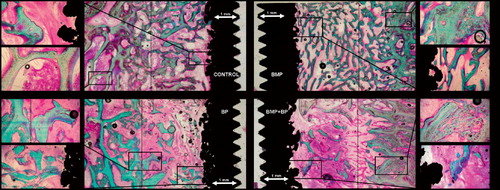 Figure 30. Study I; representative histology. All four implant sections are from the same dog (Ti implants). Upper left: Control implant with allograft only. Upper right: Allograft added rhBMP‐2. Lower right: Allograft added pamidronate. Lower left: Allograft added rhBMP‐2 and pamidronate in combination.