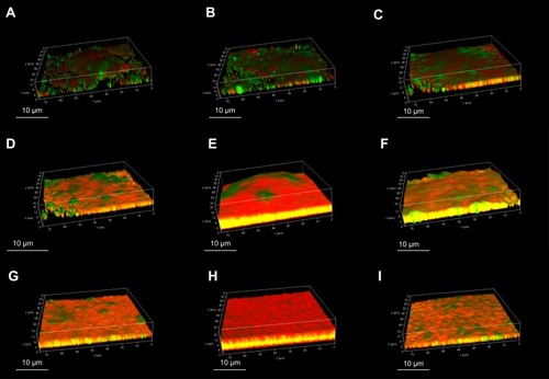 Figure 2 Confocal laser scanning microscopy of in vitro biofilm production of Staph. aureus isolates. The biofilms were stained with LIVE/DEAD stain. Green represents live cells, red represents dead cells and eDNA, and yellow represents a mixture. (A) SA0007; (B) SA0012; (C) SA0019; (D) SA0020; (E) SA0023; (F) SA0028; (G) SA0031; (H) SA0047; (I) SA0052.