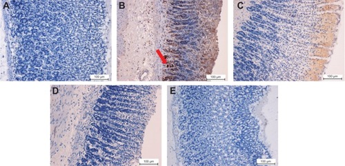 Figure 8 Immunohistochemical analysis of Bax protein expression from five groups of rats, namely: (A) normal control, (B) lesion control, (C) low dose of EEAM, (D) high dose of EEAM, and (E) omeprazole control. Immunohistochemistry staining showed downregulation of Bax in groups C–E. (A) and (B) are presenting the normal control and lesion control groups, respectively. The red arrow shows Bax protein accumulation in gastric tissue (20×).