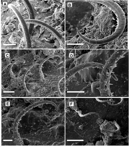 Figure 2. Hooked setae found on the rostral and central region of the carapace of Inachus communissimus sampled in the Northern Adriatic Sea: shaft curved, denticules on the inside of the curve that appear to form distally a single row (A,B); hooked setae found on the lateral, central and back regions of the carapace: shaft curved with denticules all around and all along (C–E); hooked setae found on the lateral and back region of the carapace (F). Scale bars: A–C, 50 μm. D and E, 20 μm. F, 100 μm.